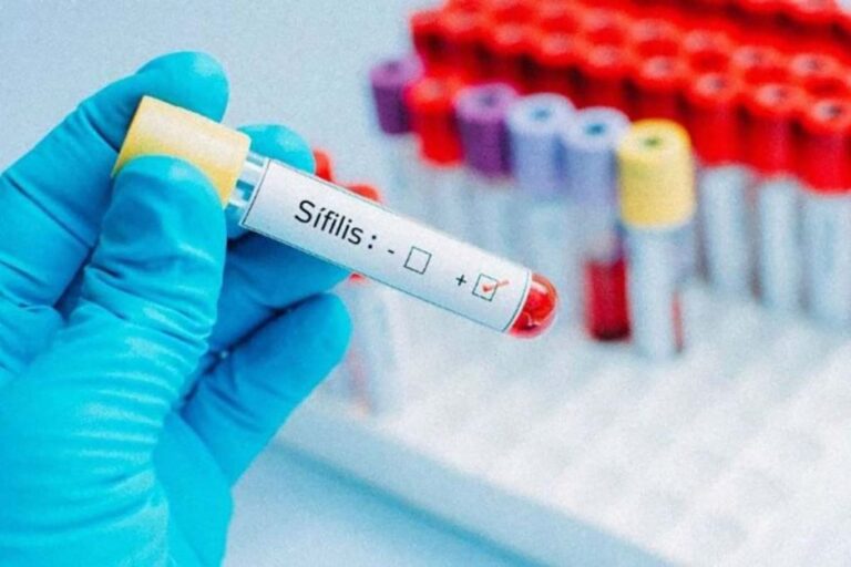 Ante el retiro de Nación, Salta refuerza la prevención por el aumento de sífilis y VIH